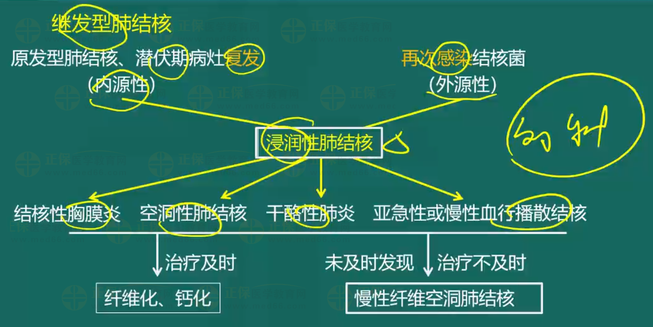 肺結核-3