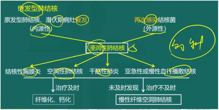 繼發(fā)型肺結核